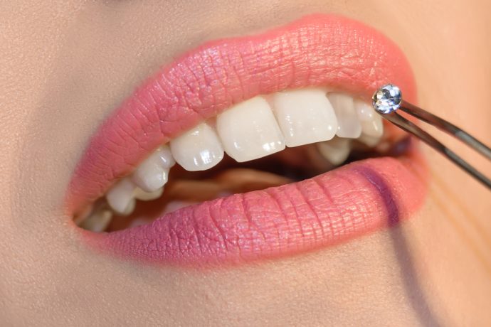 Dental Jewelry Twin Cities - Tooth Gems