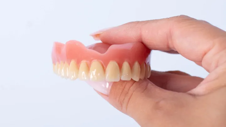 Implant supported dentures