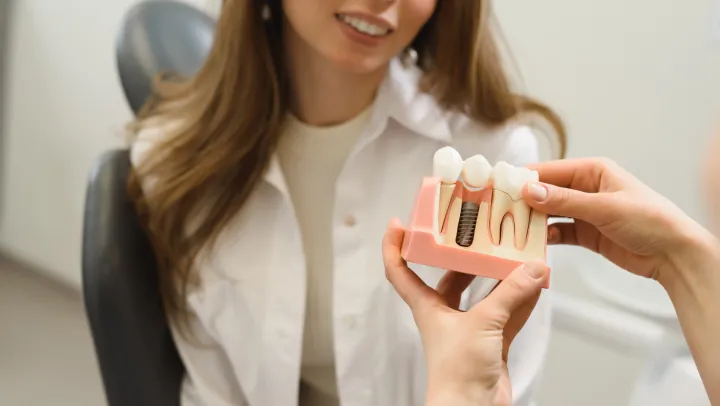 Single tooth implants