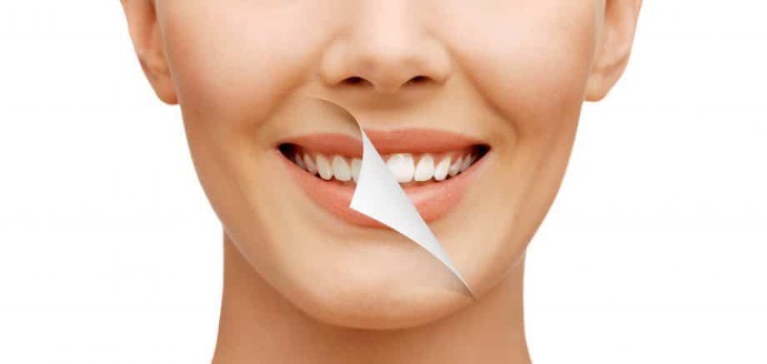 Woman smiling with bright white teeth