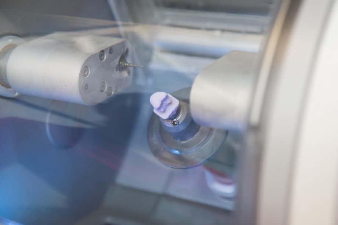 Close-up of advanced dental treatment equipment