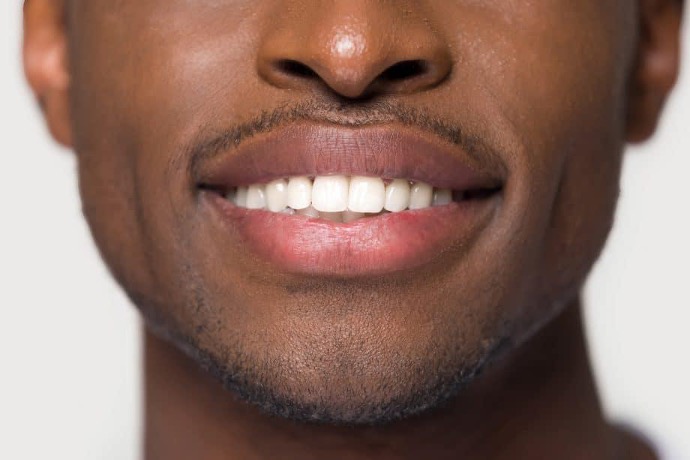 Healthy smile showing natural white teeth